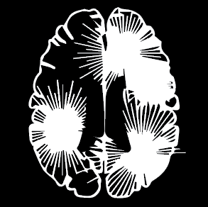 Stylized image of a brain with bursts of light at location of damage.
