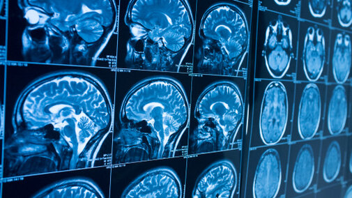 MRIs